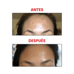Ácido glicólico 7% Glycolic acid 7% toning solution miniatura 2